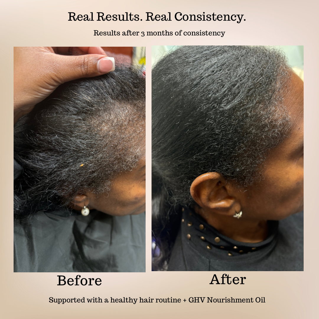 GHV Hair & Scalp Nourishment Oil- 4oz