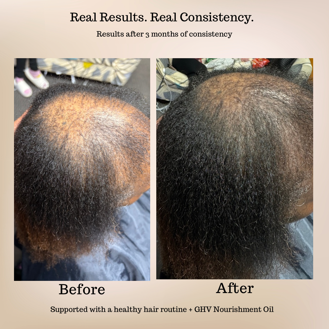 GHV Hair & Scalp Nourishment Oil- 4oz