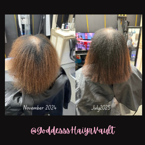 GHV Hair & Scalp Nourishment Oil- 4oz