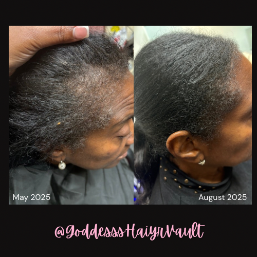 GHV Hair & Scalp Nourishment Oil- 4oz